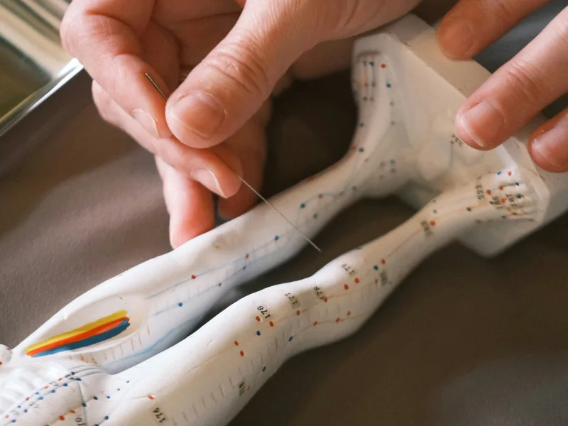 Acupuncture at Northern Roots Family Spinal Care in Clear Lake