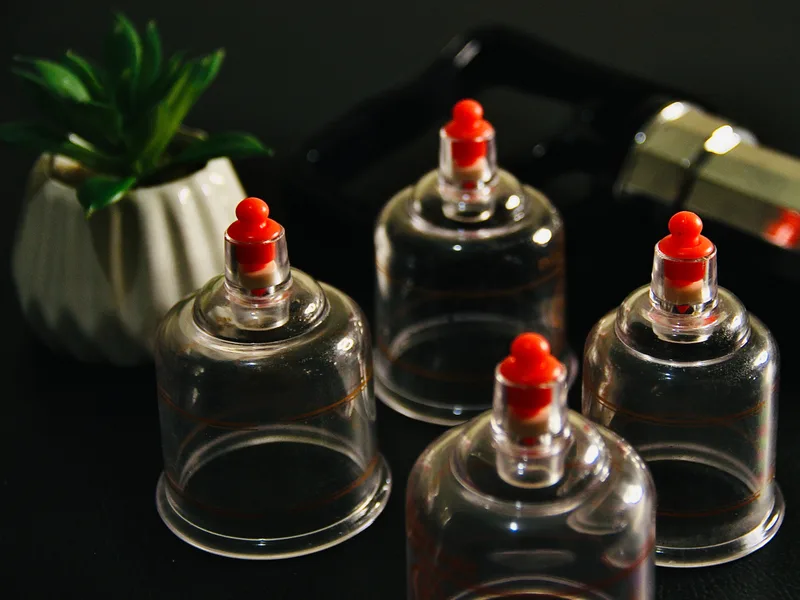 How Cupping Therapy works at Northern Roots Family Spinal Care