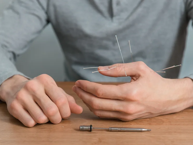 Dry Needling at Northern Roots Family Spinal Care in Clear Lake