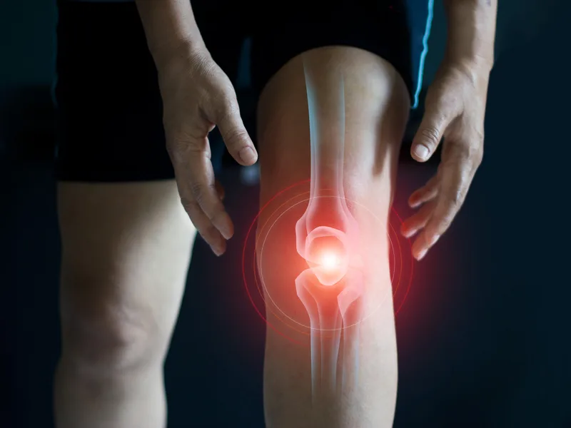 How Northern Roots Family Spinal Care treats arthritis in Clear Lake